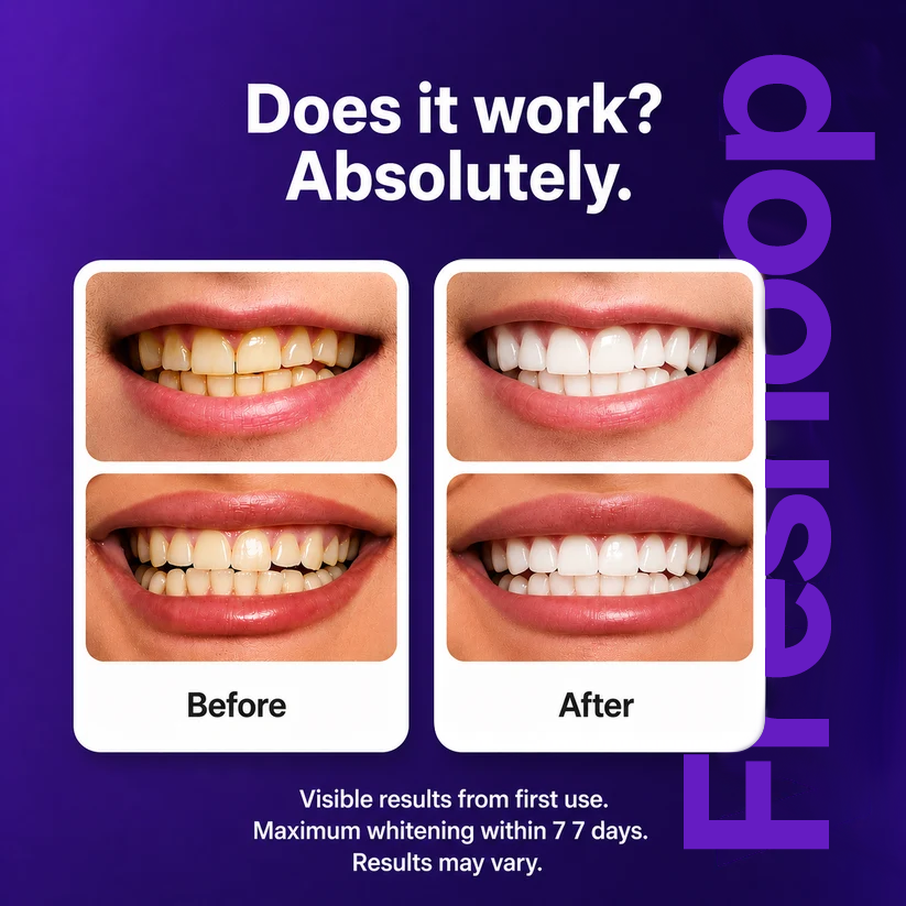 Freshoop Purple Teeth Whitening Strips™