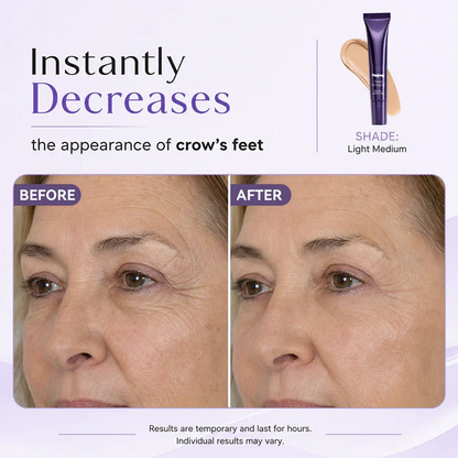 Freshoop Eye Gel, Hydrating & Nourishing Eye Cream for Delicate Eye Area Skin