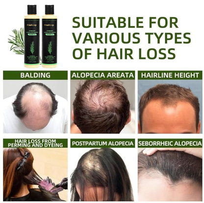 🔥LAST DAY 50% OFF - 🌿Freshoop® Organic Rosemary Hair Growth Shampoo