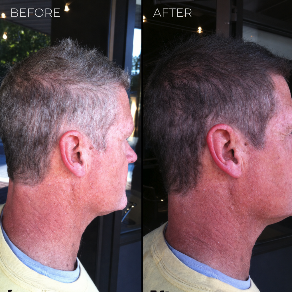 Clinclii Instant Gray Coverage Stick