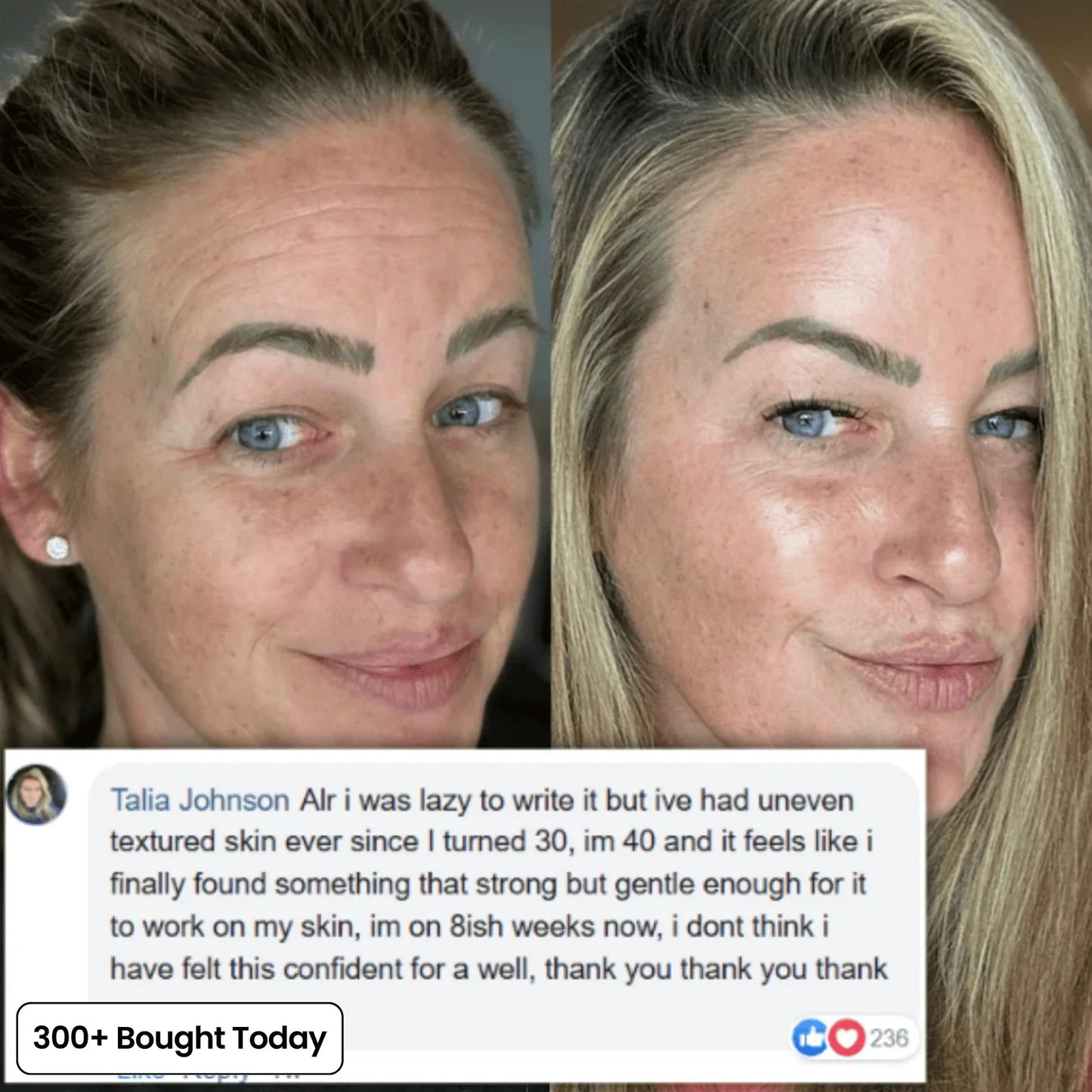 ✨Your Pocket-Sized Secret to Dewy, Plump & Radiant Skin
