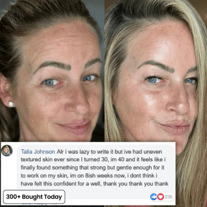 ✨Your Pocket-Sized Secret to Dewy, Plump & Radiant Skin