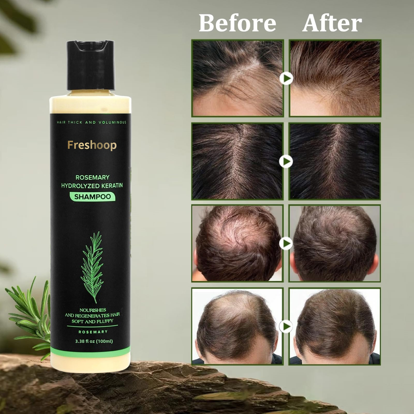 🔥LAST DAY 50% OFF - 🌿Freshoop® Organic Rosemary Hair Growth Shampoo