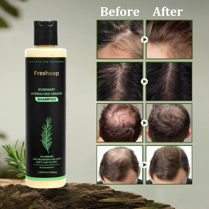🔥LAST DAY 50% OFF - 🌿Freshoop® Organic Rosemary Hair Growth Shampoo