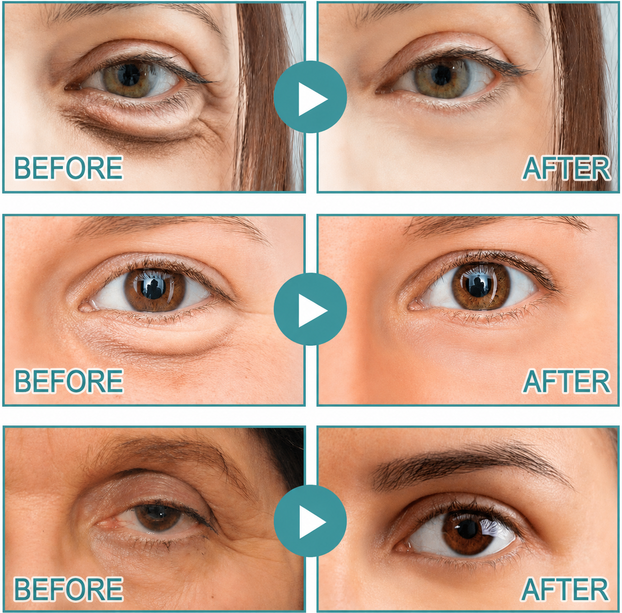 Freshoop | Dissolving Microneedle Eye Patches